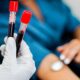 From Blood Sample to Breakthrough: How Reliance’s New Patent Could Transform Early Cancer Diagnosis in India